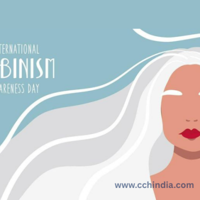 Albinism Awareness Day: A Call for Understanding