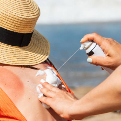 Top 10 Tips for Avoiding Sunburn